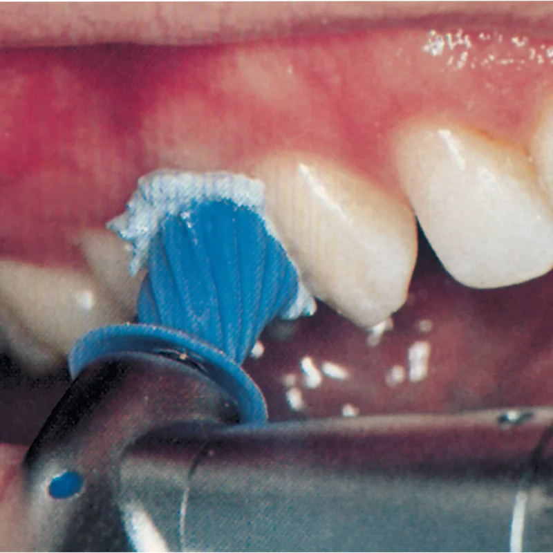 denta-tec-120260711085718795527