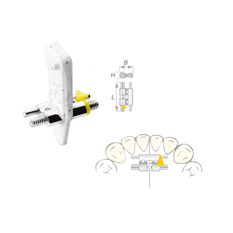 denta-tec-120260711110658811197
