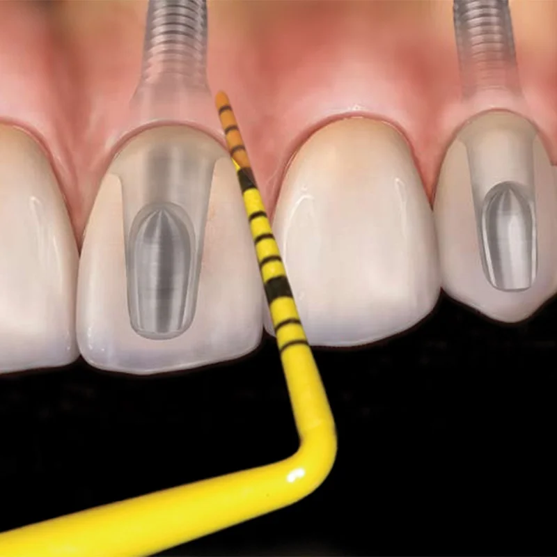 denta-tec-220260710172504643355